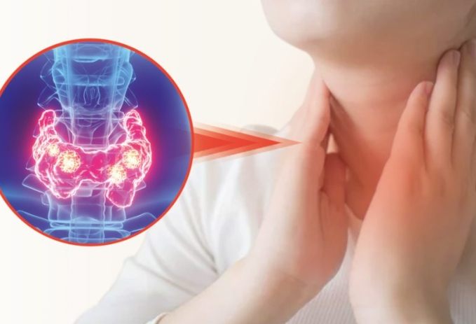 甲狀腺結節腫症狀飲食 甲狀腺結節腫症狀飲食