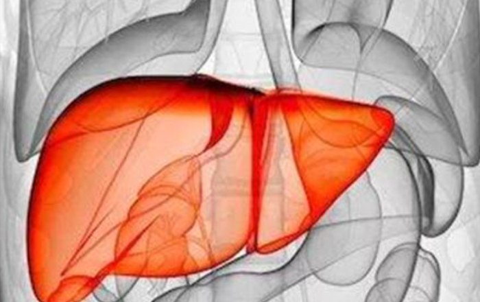 肝結節怎麼辦 肝結節怎麼辦