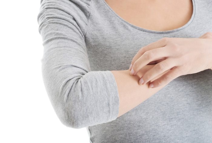 結節性癢疹原因 結節性癢疹原因