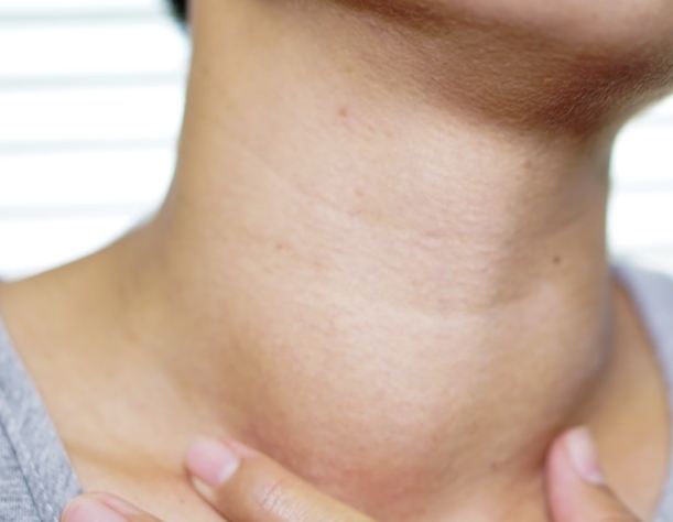 甲狀腺結節腫症狀病因 甲狀腺結節腫症狀病因