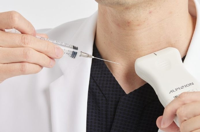 甲狀腺結節穿刺副作用