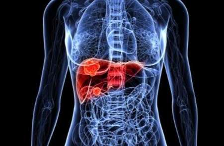 肝臟結節增生 肝臟結節增生