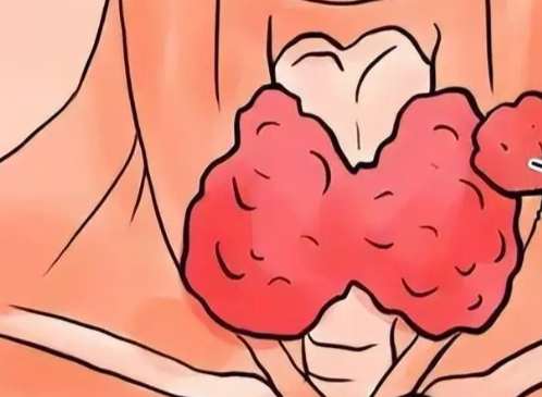 甲狀腺開刀復原期 甲狀腺開刀復原期