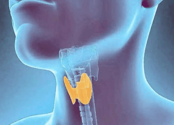 甲狀腺結節常見問題