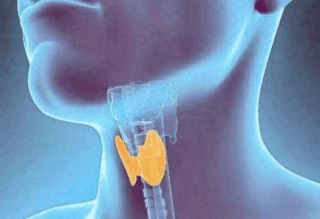 甲狀腺結節前兆 甲狀腺結節前兆