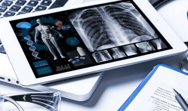 毛玻璃結節症狀 毛玻璃結節症狀