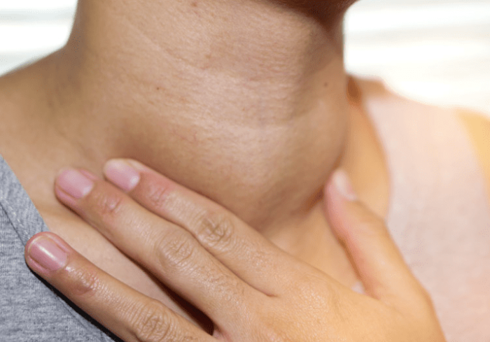 甲狀腺結節要開刀嗎