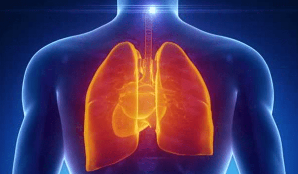 肺結節症狀 肺結節症狀