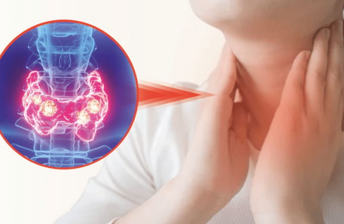 甲狀腺結節基本信息