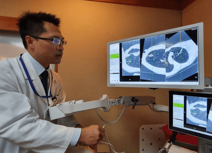 毛玻璃結節治療 毛玻璃結節治療