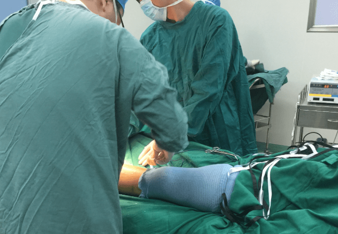 毛玻璃結節手術方式