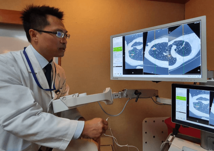 毛玻璃結節症狀