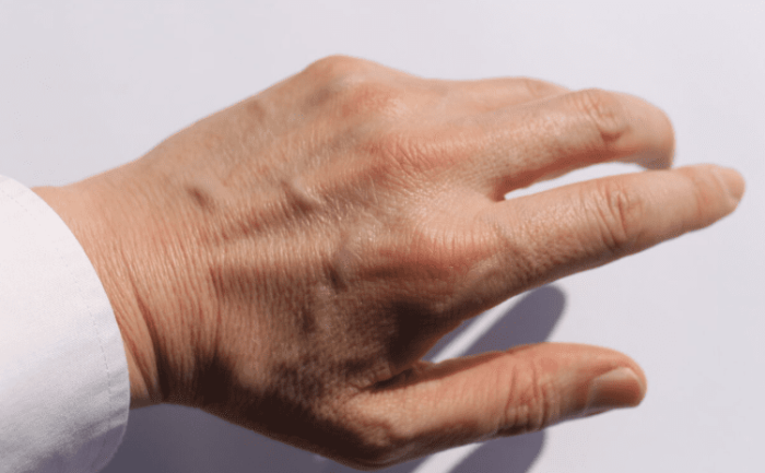 毛玻璃結節檢查